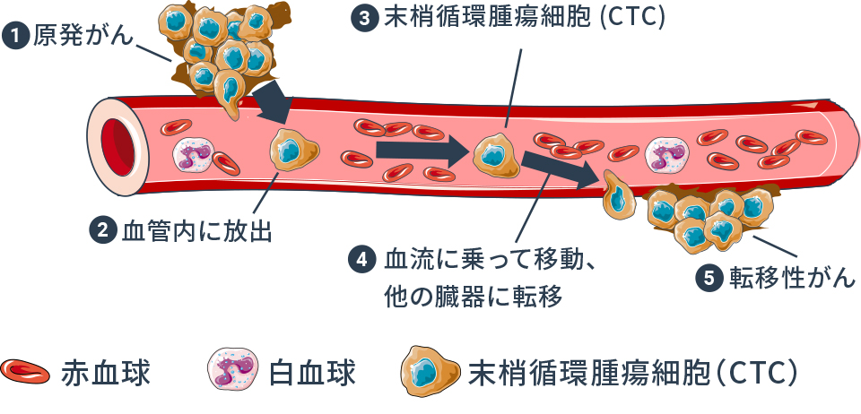 CTC検査について
